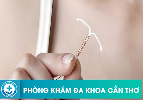 17 Tuổi Đặt Vòng Tránh Thai Được Không