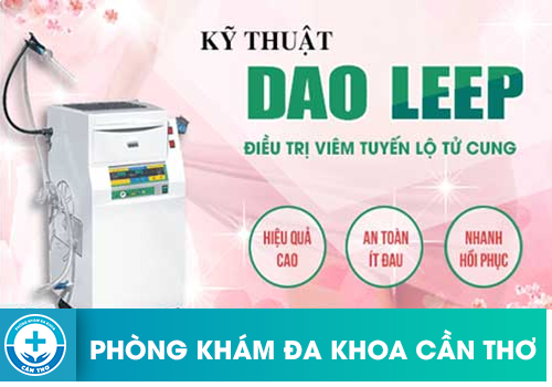 Chữa viêm lộ tuyến cổ tử cung bằng phương pháp Dao Leep