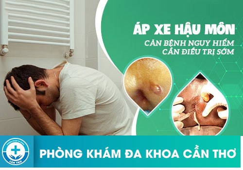 Triệu chứng apxe hậu môn