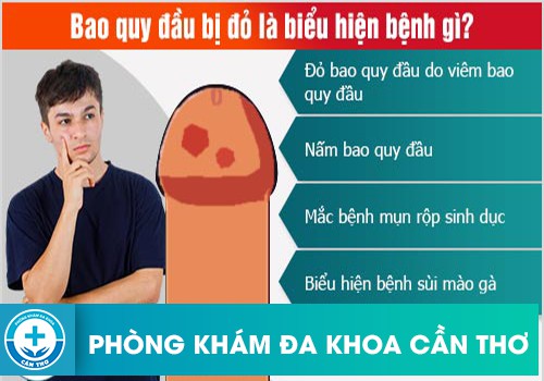 Nguyên nhân khiến cho bao quy đầu bị đỏ và lột da