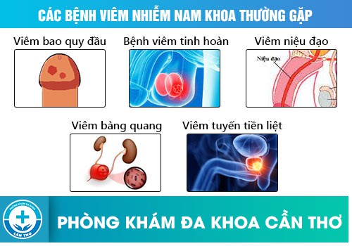 tong-hop-nhung-benh-nam-khoa-thuong-gap