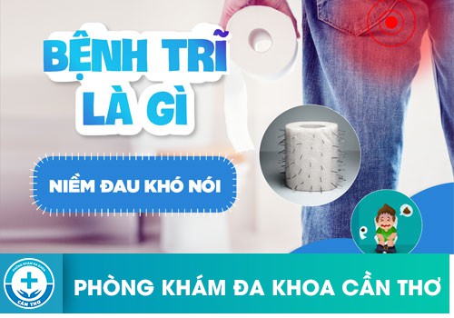 Cách Điều Trị Bệnh Trĩ Không Đau Hiệu Quả Hiện Nay