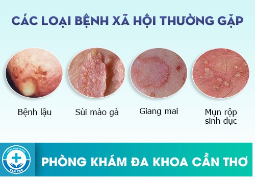 Bệnh Xã Hội Nào Nguy Hiểm Nhất Ở Nữ Giới