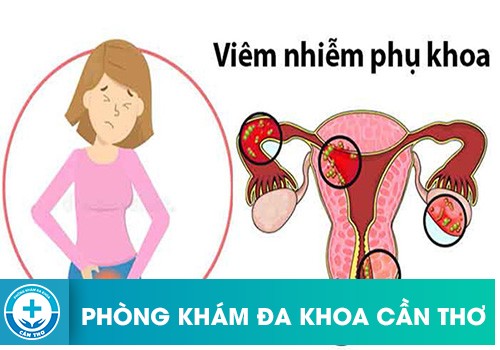 Một số bệnh viêm phụ khoa gây đau lưng