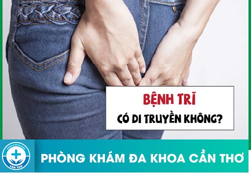 Bệnh trĩ có di truyền không?