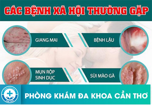 Những Bệnh Xã Hội Có Gây Vô Sinh Ở Nữ Bạn Nên Biết