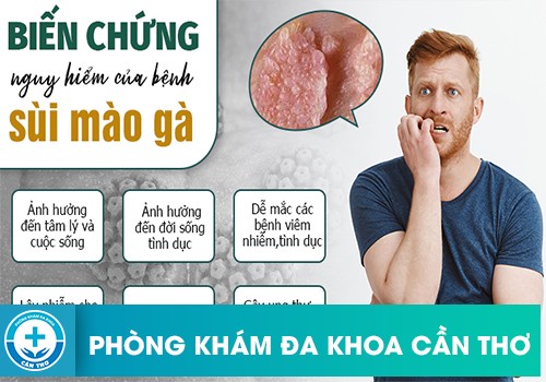 biến chứng sùi mào gà