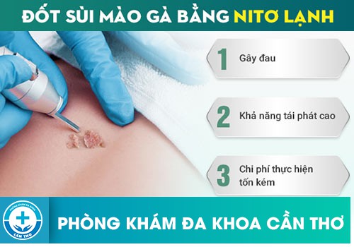  Phương pháp áp lạnh bằng Nitơ lỏng