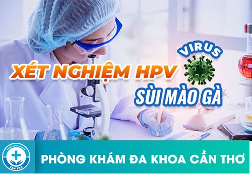 xét nghiệm sùi mào gà