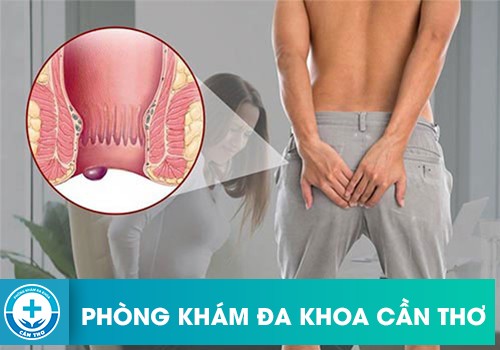 Da thừa hậu môn có tái phát trở lại sau khi cắt không?