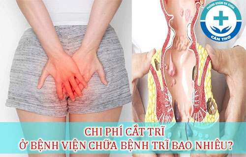 bệnh viện chữa bệnh trĩ