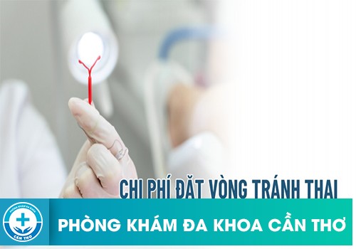 Chi Phí Đặt Vòng Tránh Thai Ở Bệnh Viện Hiện Nay Bao Nhiêu Tiền