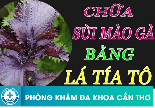 dung nghe va la tia to ho tro dieu tri sui ma co duoc khong