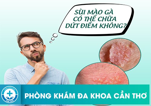 Có Cách Chữa Dứt Điểm Bệnh Sùi Mào Gà Không?