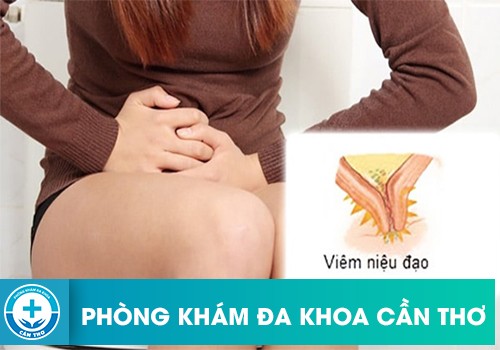 Có Nên Tự Dùng Thuốc Doxycycline Trị Viêm Niệu Đạo Không?