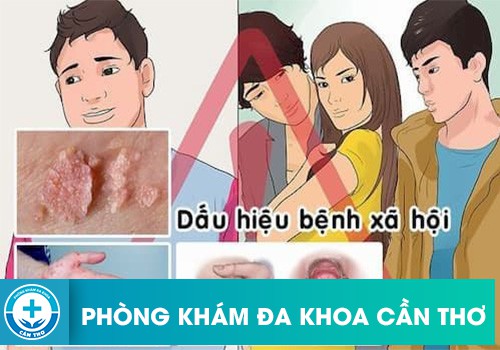 triệu chứng bệnh xã hội