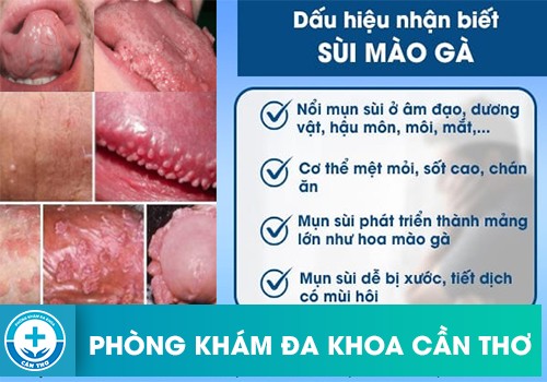 Dấu hiệu nhận biết sùi mào gà phát triển