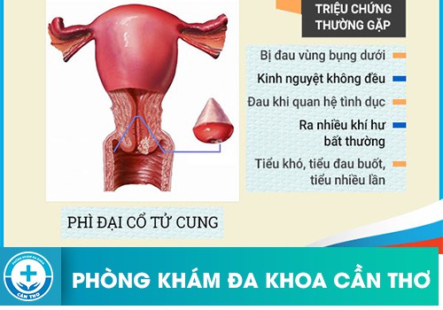 Triệu chứng thường gặp của phì đại cổ tử cung