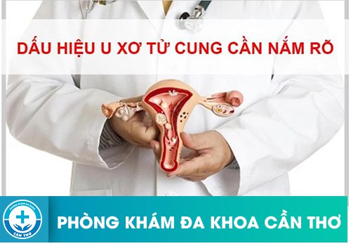 Dấu hiệu nhận biết bệnh u xơ tử cung ở nữ