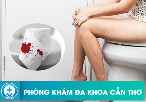 Đi Cầu Ra Máu Tươi Đau Rát Hậu Môn Có Phải Bị Trĩ