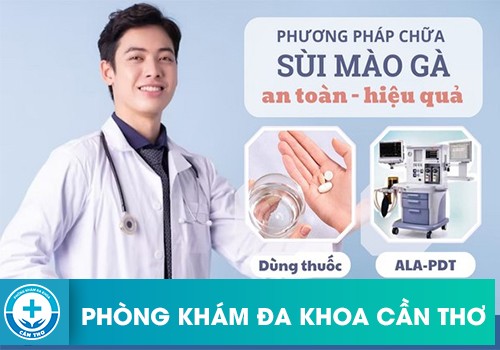 Những phương pháp điều trị sùi mào gà hiệu quả