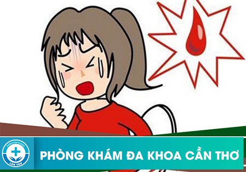 Nên làm gì khi mắc bệnh trĩ 