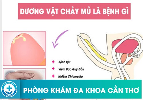 ⚕️ Dương Vật Chảy Mủ Là Bệnh Gì?