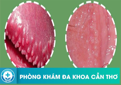 Gai sinh dục có nguy hiểm không?