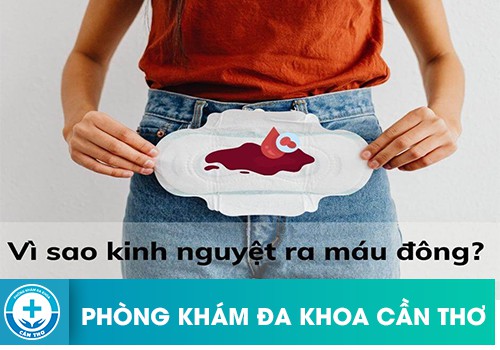 Tại sao trong chu kỳ kinh nguyệt đột nhiên xuất hiện cục máu đông? 