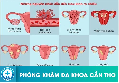 Kinh Nguyệt Ra Nhiều Uống Thuốc Gì