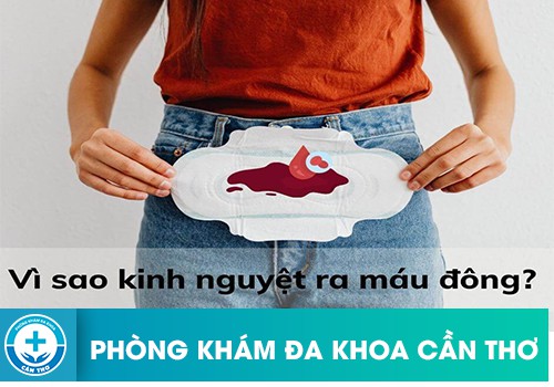 Xuất hiện cục máu đông trong chu kỳ kinh nguyệt có nguy hiểm