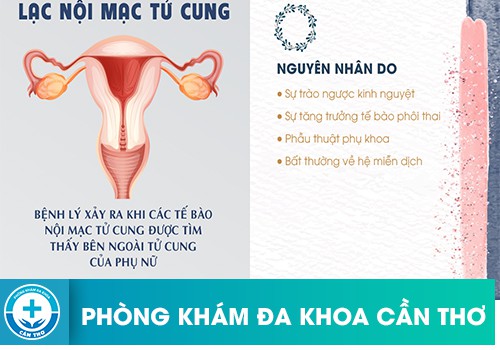 chi phi dieu tri lac noi mac tu cung hien nay vao khoang bao nhieu