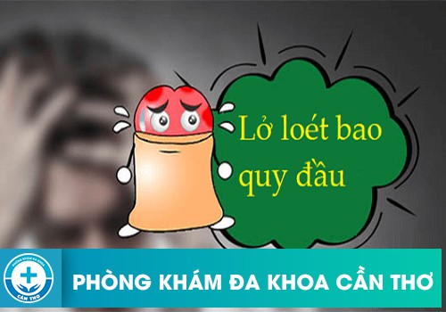 Dấu hiệu lở loét ở đầu dương vật đang cảnh báo bạn điều gì?