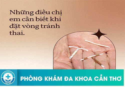 Những lưu ý khi đặt vòng tránh thai