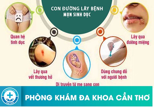 Bệnh mụn rộp sinh dục có lây truyền từ mẹ sang con không?