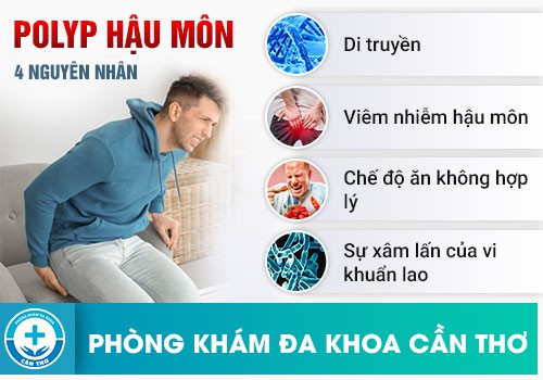 Nguyên nhân gây bệnh polyp hậu môn