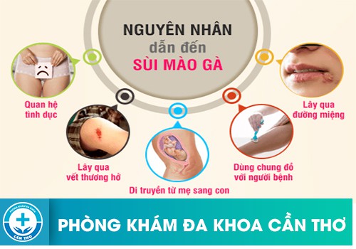 Nguyên nhân dẫn đến sùi mào gà