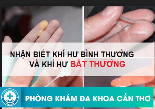 Hình ảnh minh họa khí hư bình thường