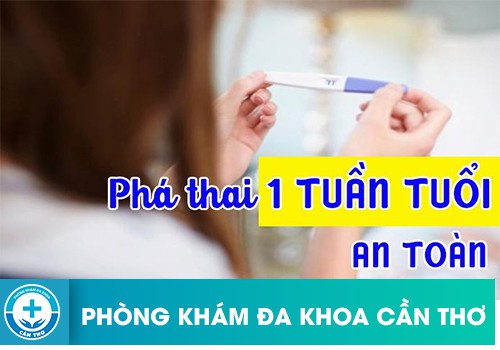 Có nên phá thai 1 tuần tuổi không?