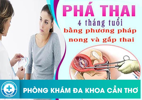 Phá thai 4 tháng tuổi nên dùng phương pháp nào