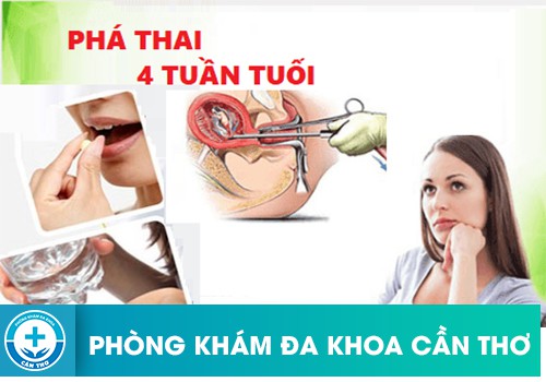 thai 4 tuần phá bằng cách nào 