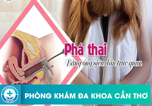 Phương pháp phá thai trực quan siêu dẫn là gì