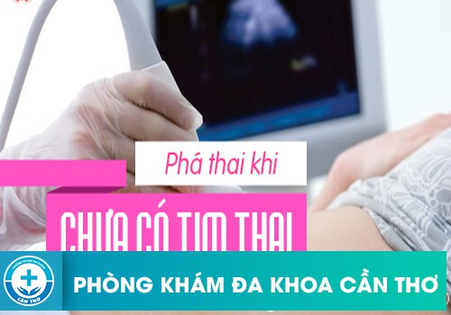 Phá thai chưa có tim thai