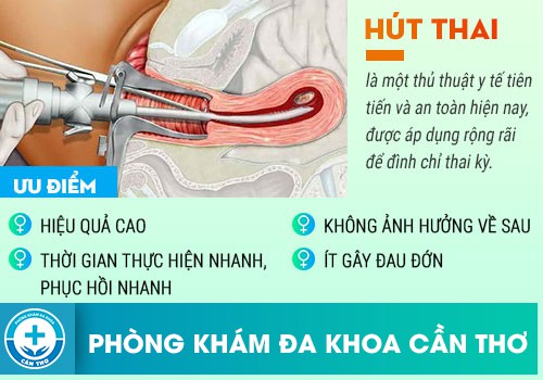 Ưu nhược điểm của hút thai chân không