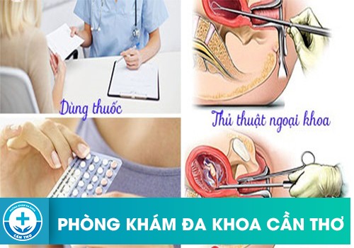 Các phương pháp phá thai an toàn hiện nay