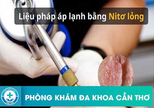 Các phương pháp điều trị sùi mào gà hiện nay