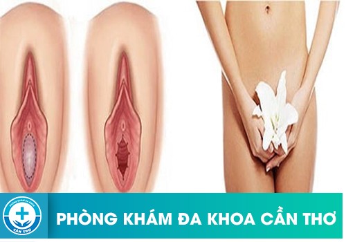 Quy trình vá màng trinh được diễn ra như thế nào?