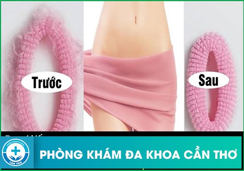 Làm gì để vùng kín se khít và hồng hào?