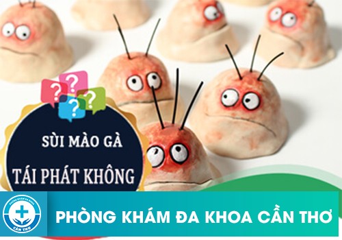 Sùi Mào Gà Có Tự Tái Phát Không