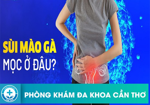 sùi mào gà mọc ở đâu